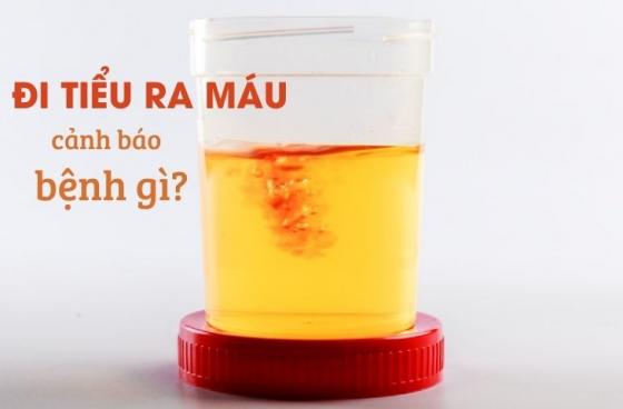 tieu-ra-mau-1.jpg